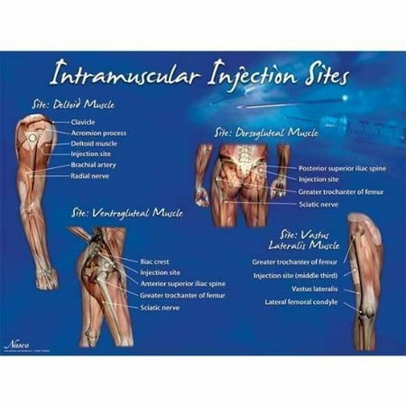 IM Injection Sites Poster, MPN: LF00695U By Nasco