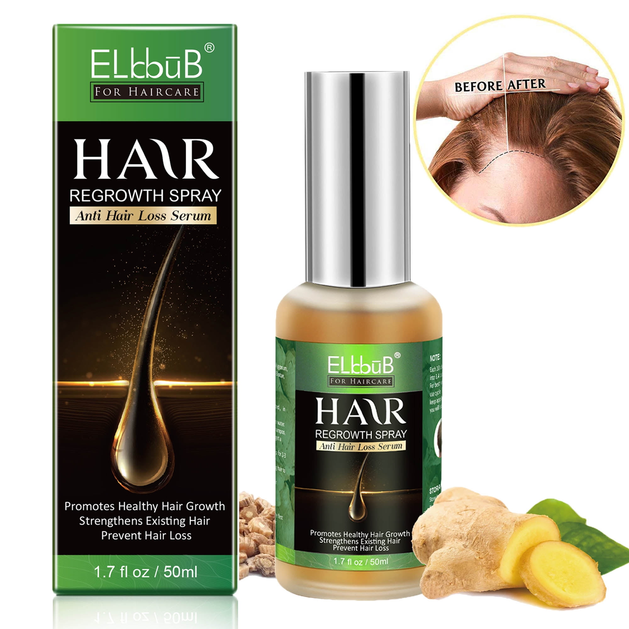 Elbbub Anti Hair Loss Spray Ginger Hair Growth Serum,Nourish Scalp,Repair  Follicles,Stimulate Hair Regrowth for Women Men,/50ml 