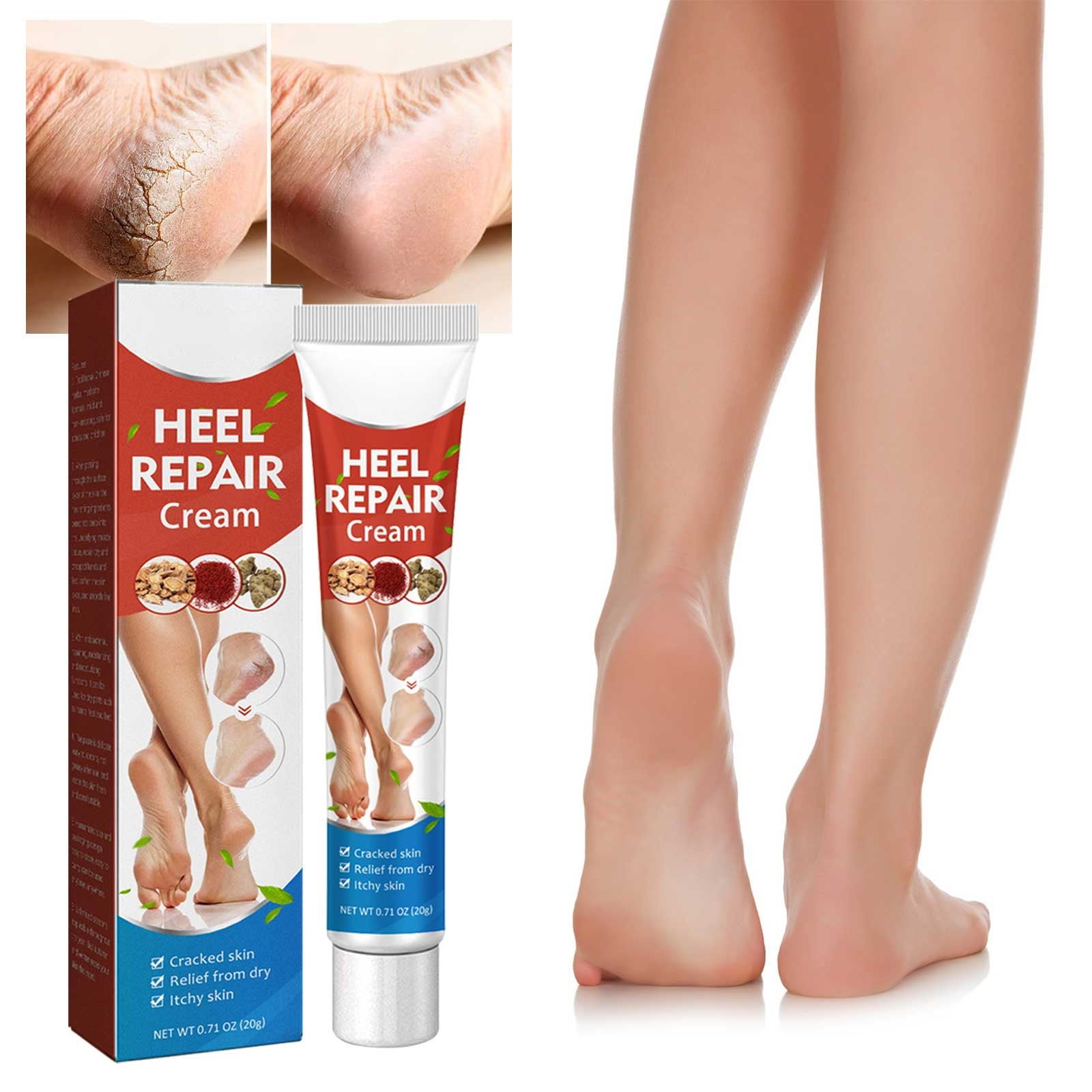 Heel s Creams Exfoliating Dry And Cracked Feet To Dead Skin Callusess