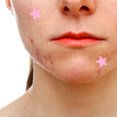 thumbnail image 3 of Star Blemish Patches, 2Pcs Adorable Fade  Mark Hydrocolloid Dots Heal Skin  For Makeup, 3 of 8
