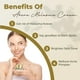 thumbnail image 2 of Crema de melasma ABERA corrector de manchas oscuras, 20 ml, para mujeres y hombres, 2 of 8