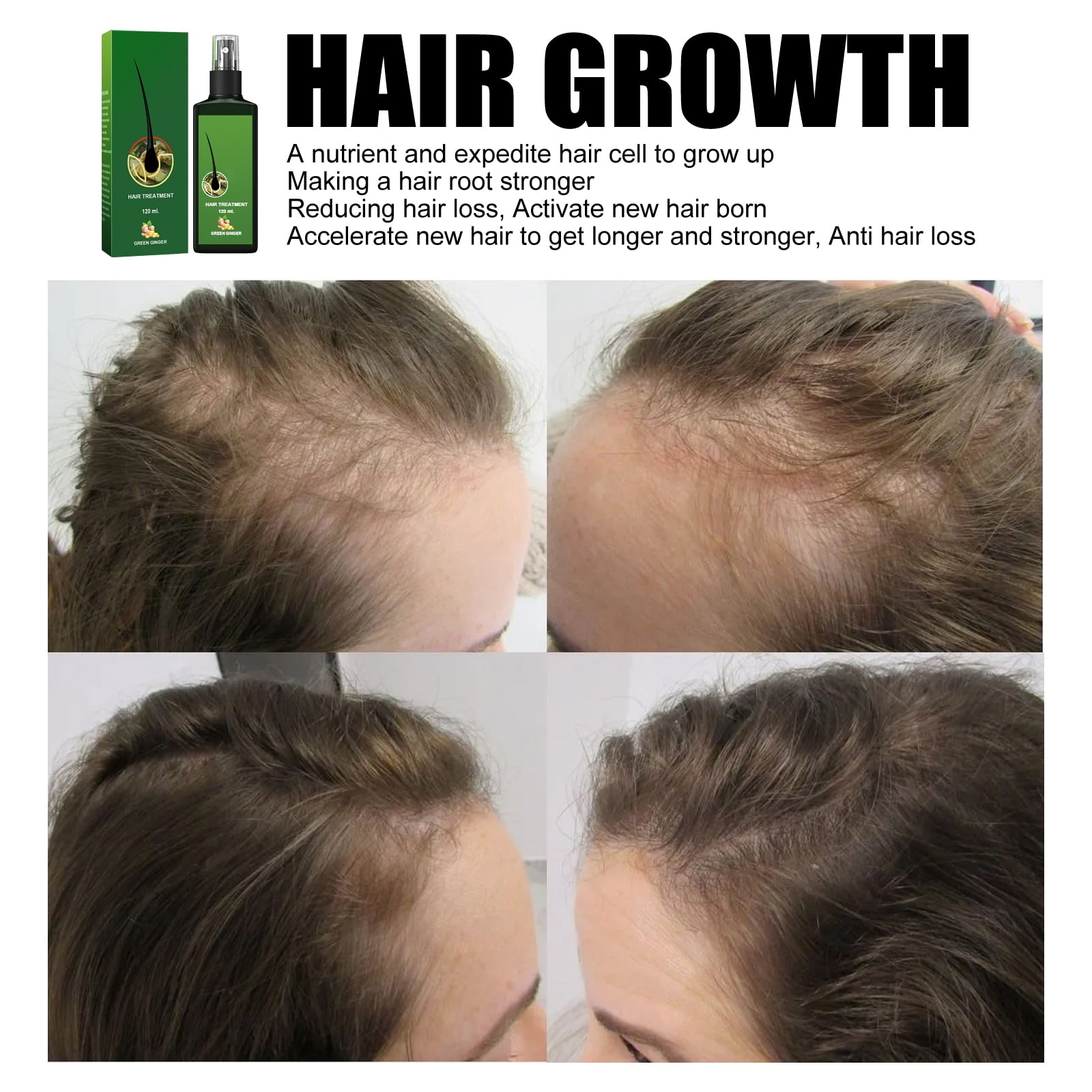 Alvantor Ginger Hair Growth Serum for Strengthening & Nourishing, 4.05 fl oz