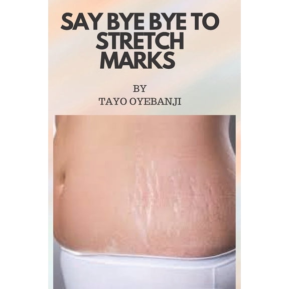 Say bye bye to stretch marks : Take back your confidence and send stretch marks out of your life! (Paperback)