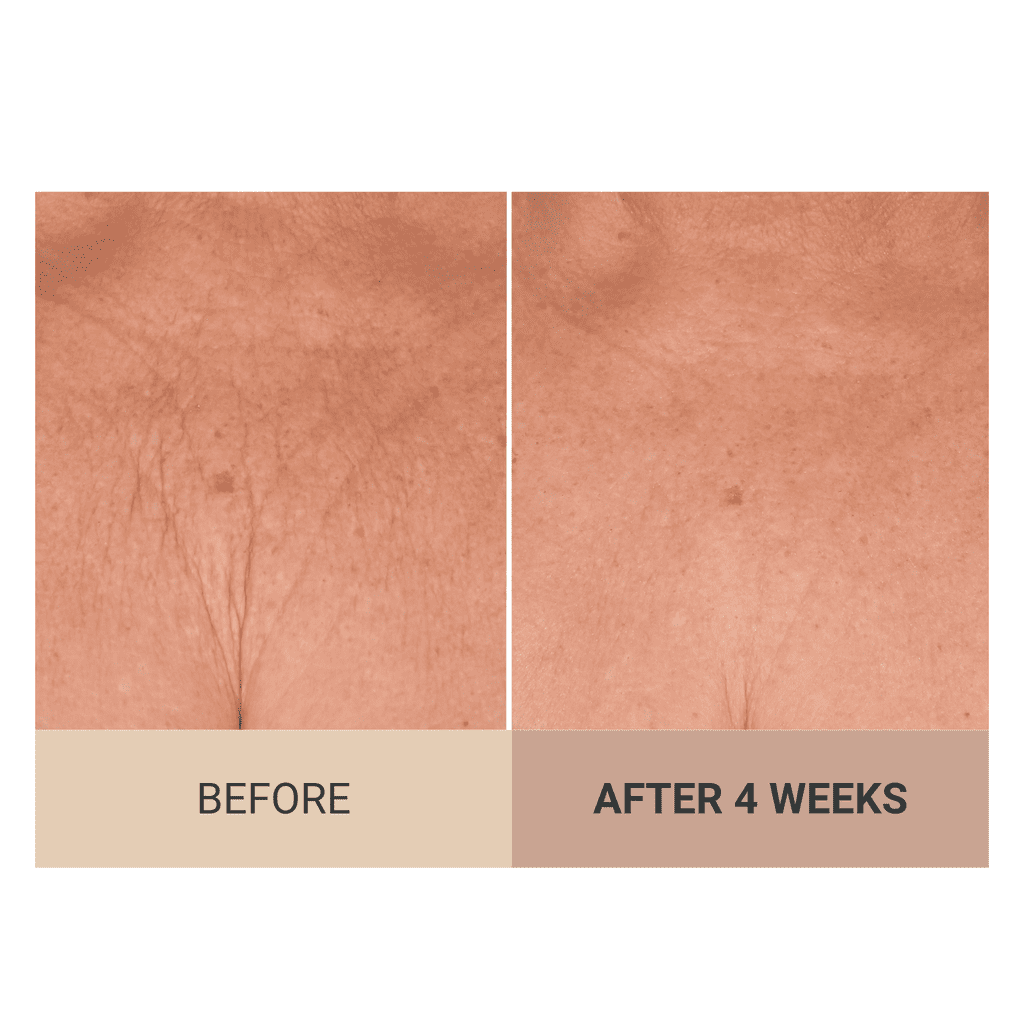 Consult Beaute Champagne Lift Hydrating Firming Body Cream with Pink Pepperslim for Crepey Skin Moisturizer Tightens, Tones & Hydrates Dry Skin on Arms & Legs - Vanilla Absolute 8 oz.