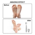 thumbnail image 4 of Portable Stainless Steel Foot Scraper Foot Care Tool Dead Skin Remover Scraper for Travel, 4 of 8