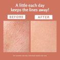 thumbnail image 5 of M3 Naturals Frankincense Essential Massage Oil for Scars, Stretch Marks & Fine lines, Firming, Hydrating, Smoothing & Calming Formula with Collagen, Stem Cells, Lavender & Grapefruit, 8 fl oz, 5 of 14