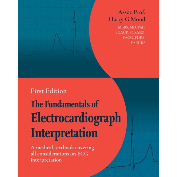 The Fundamentals of Electrocardiograph Interpretation: A medical textbook covering all considerations on ECG interpretat, (Paperback)