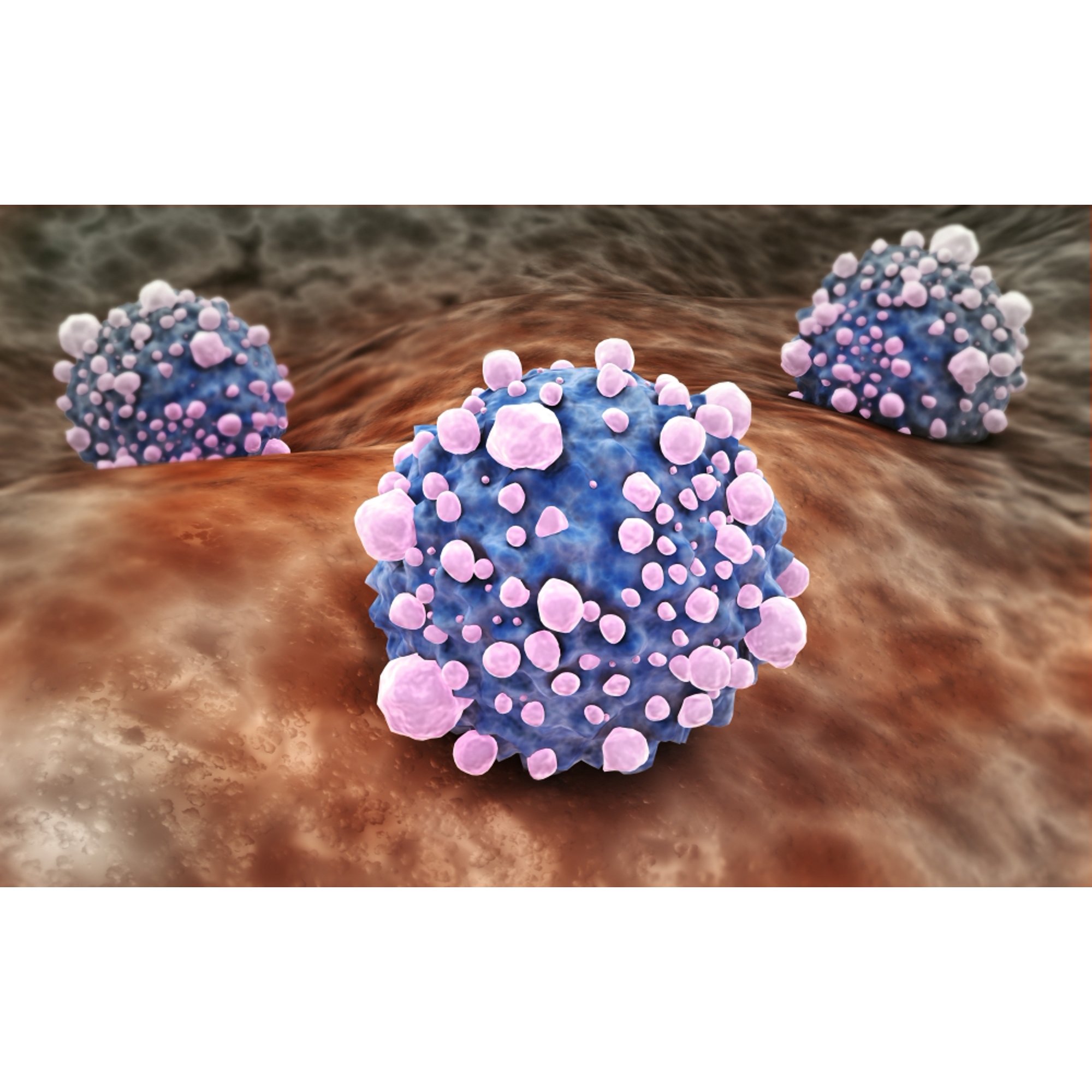 Microscipic view of pancreatic cancer cells Canvas Art - Stocktrek Images (36 x 23)