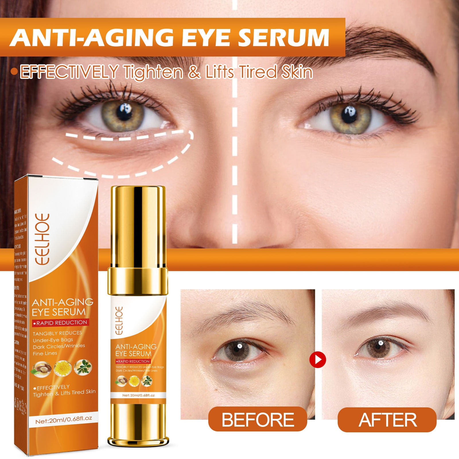 20ml Quick Reducing Eye Essence, Puffy Eye Care, Male And Female Eye