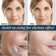 thumbnail image 2 of 120 hilos de seda de colágeno, levantamiento facial, hilos de seda de colágeno compatibles con levantamiento de hilos compatibles con estiramiento de la piel, colágeno activo facia, 2 of 4