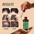 thumbnail image 4 of Batana Oil M MILLONESSENTIALS 120 ml para crecimiento del cabello orgánico puro, 4 of 6