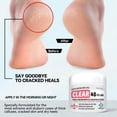 thumbnail image 2 of Crema de urea Scientific Solutions Global CLEAR 40% con ácido salicílico, 2 of 7