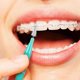 thumbnail image 5 of Palillo de Dientes CHAO Cabezal de Hilo Dental Cepillo Dental Limpiadores de Palillos de Dientes con Caja de Almacenamiento Rojo Azul Verde Naranja, 5 of 5
