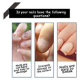 thumbnail image 4 of FeiKong Acondicionador para el crecimiento y fortalecimiento de las uñas Onycholysis Heal, Tratamiento de uñas Onycholysis, Tratamiento Onycholysis, Onycholysis Heal, 4 of 5
