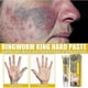 thumbnail image 3 of Skin Repair Cream Versicolor Sweat Spot Topical Application Ointment Skin Anti-itch C, 3 of 5