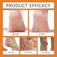 Apepal Honey Foot Moisturizing Anticrack Cream Foot Moisturizing Heel