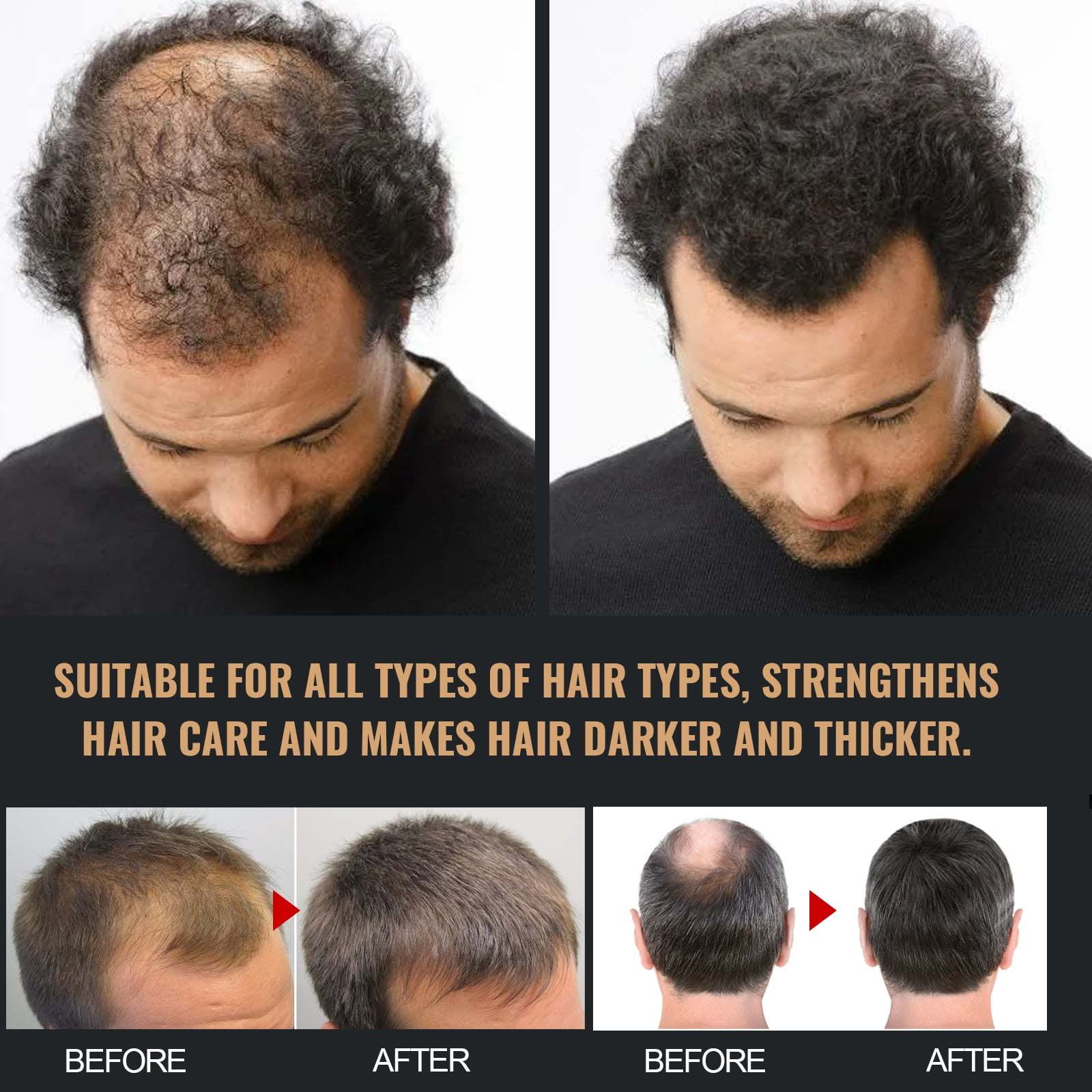 Alvantor Shampoo for Thinning Hair Volumizing Repair Strong Dense Fluffy All Hair Types, 3.38fl.oz