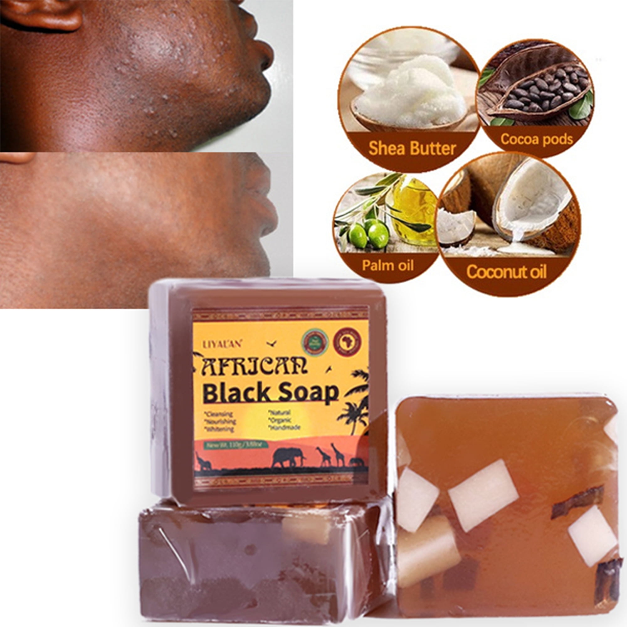 LIYAL'AN African Black Soap Face and Body Bar Soap for Oily, Blemish