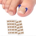 thumbnail image 1 of 100 parches correctores para uñas de los pies, sin pegamento, para pedicura, corrector para uñas encarnadas., 1 of 3