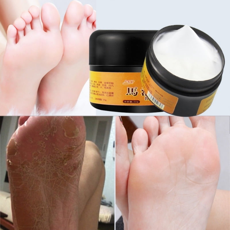 Zonghan Horse Oil Foot Hand Antifreeze Cream Treatment Dry Skin Heel Chapped Peeling Repair Beauty Skin Care Products