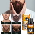 thumbnail image 2 of Beard Growth Oil 2 Pack, Nourishing Beard Growth Oil Enhancer, 2 of 5