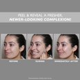 thumbnail image 2 of Gel exfoliante Peter Thomas Roth FirmX®, 30 ml, tamaño de viaje, 2 of 5
