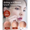 thumbnail image 3 of Parches para rostro Pimple Lab Zit, 2 paquetes (220 puntos) con herramientas, 3 of 8