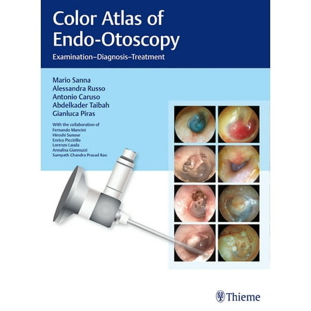 UPC: 9783132415232 | Color Atlas of Endo-Otoscopy: Examination – Diagnosis – Treatment (Hardcover)