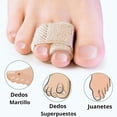 thumbnail image 2 of 10PCS Corrector Dedo Martillo y 2 Pares Separadors Juanetes, Envolturas para los Dedos, Protectores Dedos Pie, para Corregir Dedos de los Pies con Torcidos y Superpuestos, 2 of 5