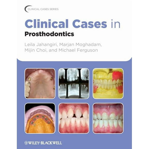 Clinical Cases (Dentistry) Clinical Cases in Prosthodontics, Book 9, (Paperback)