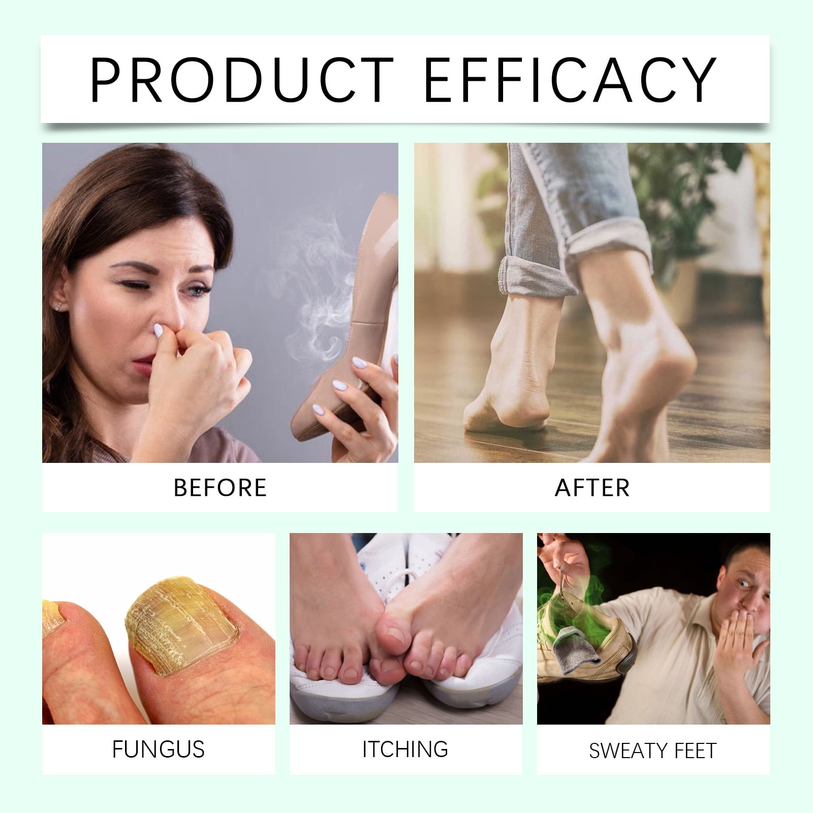 Alvantor Foot Spray with Tea Tree Oil, Moisturizing Deodorizer for Dry Cracked Heels Itchy Feet Antifungal, 3.38fl.oz