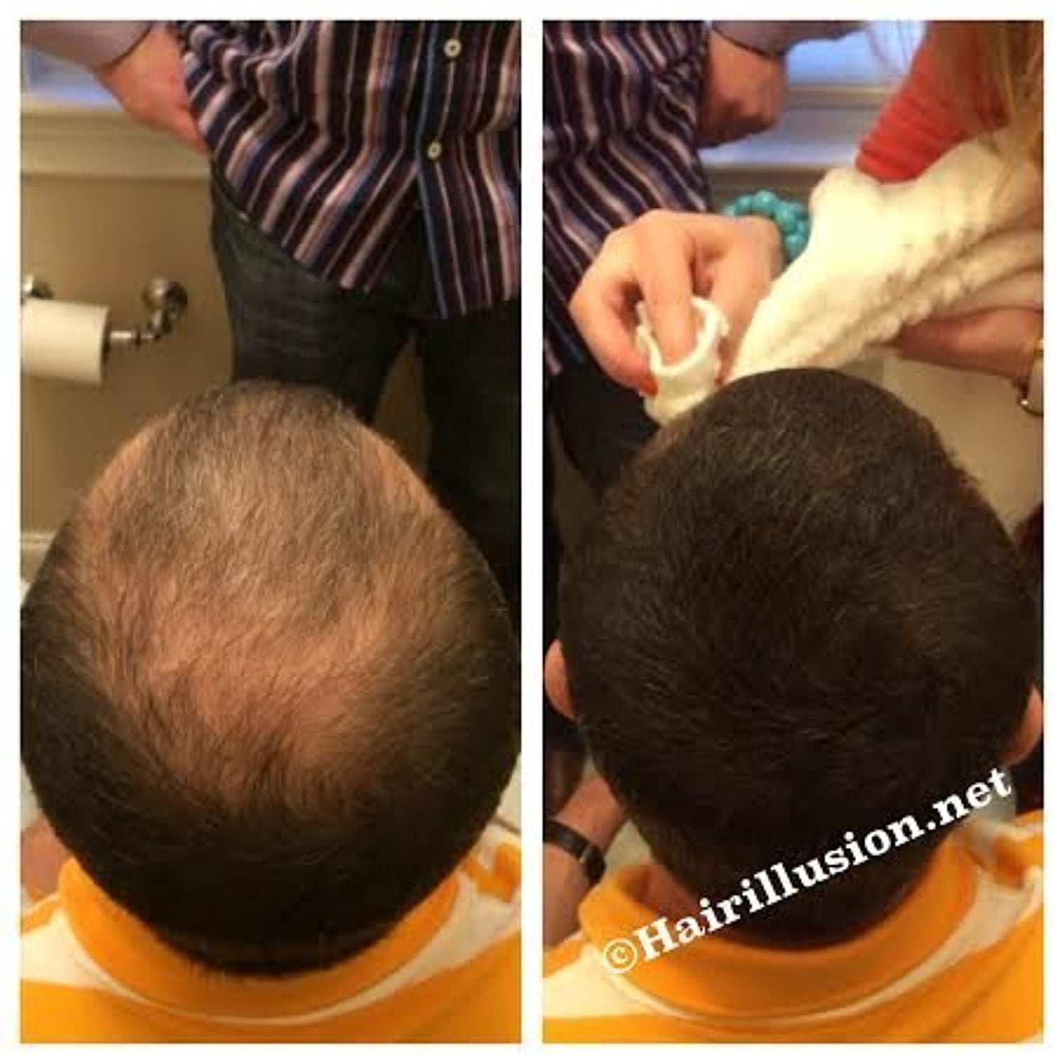 HAIR ILLUSION - 100% Real Human Hair Fibers - Not Synthetic - For Men & Women, Premium Hair Building Formulation, Brown - 18g