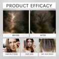 thumbnail image 4 of Essential Oil for Hair Growth, Scalp Health, and Moisture Repair with Rosemary, 4 of 5