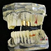 14k Gold Plated Double Two Tooth Grillz Left Side 2-Tooth Caps Slugs Hip Hop Grills