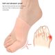 thumbnail image 1 of Corrector de juanetes Corrector de pulgar separado Enderezador de hallux valgus (A) Ndcxsfigh Cuidado Belleza, 1 of 7