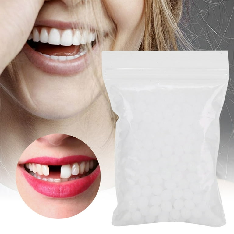 Teeth Repair Beads for Missing Tooth Filling Material with Broken Teeth,  Multifunction Teeth Repair Set Plastic(10g)