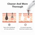 thumbnail image 3 of Limpiador facial eliminador de puntos negros HUOGUO Vacuum Suction, 3 of 5