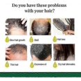 thumbnail image 3 of Ginger Anti Hair Loss 7 Days Oil, Ginger Hair Growth Oil, Natural Ginger Essential Oil for Hair Growth, Nourishes Scalp & Strengthens Hair Roots, 3 of 5