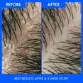 thumbnail image 4 of Head & Shoulders Avocado Oil Anti-Dandruff Shampoo, 4 of 11