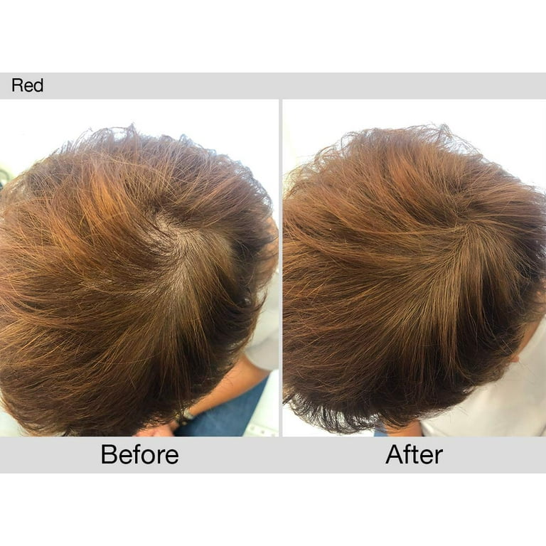 Joan Rivers Without Wig