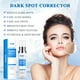 thumbnail image 2 of Eliminador de manchas oscuras VBBV para rostro y cuerpo, 50 ml para mujeres y hombres, 2 of 8