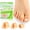 3 Size, 12 Pack，Beige, variant on Povihome Hammer Toe Straightener Corrector, 12 Pack Silicone Toe Splints for Pain Relief, Comfortable Toe Separators for Overlapping Toes, Bunions, for Men & Women (Small,Beige)