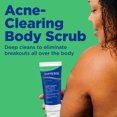 Differin Acne Clearing Salicylic Acid Body Scrub, Salicylic Acid, 8 fl