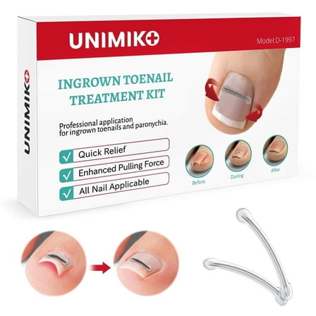 Unimiko Ingrown Toenail Corrector Kit & Curved Nail Repair : Quick & Easy Solution - 6 Pcs (0.71/0.75/0.79in) for Effective Treatment
