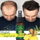 thumbnail image 2 of Aceite esencial para el crecimiento del cabello para hombres y mujeres, suero efectivo de crecimiento rápido, previene la caída del cabello, tratamiento del cuero cabelludo, 5/15/30/50ml, 2 of 3