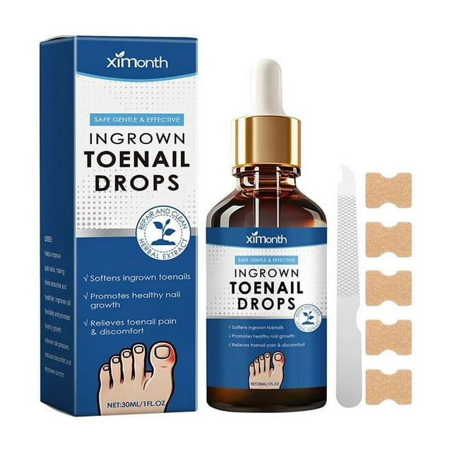 SharkTRUE 30ml Ingrown Toenail Treatment Drops - Natural Correction Best Cuticle Oils