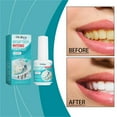 thumbnail image 4 of Pintura dental, pulidor de dientes, pintura instantánea para dientes, sérum limpiador dental para pulir y eliminar manchas, 15 ml. Cuidado dental., 4 of 8