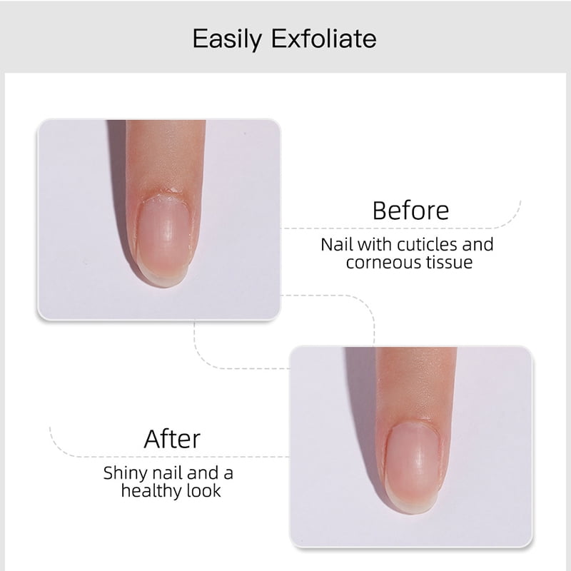 Buy Cuticle Remover Gel Cream Nail Skin Softener Professional Nail