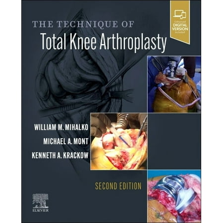 The Technique of Total Knee Arthroplasty (Hardcover)