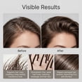 thumbnail image 3 of Yatlte Hair Strengthening Shampoo, Repairs Damage & Defend Against Future Breakage | Replenishes Hydration | For Coily, Curly, Straight, and Wavy, 3 of 5